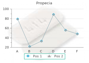 5 mg propecia otc