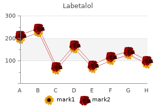 buy discount labetalol 100mg