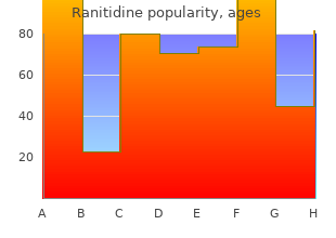 cheap 150 mg ranitidine