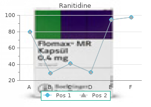 discount ranitidine 300 mg free shipping