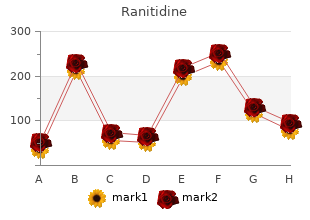 buy discount ranitidine 300 mg