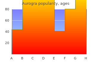 buy cheap aurogra 100 mg