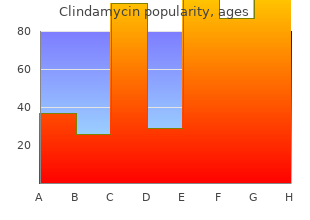 safe clindamycin 150mg