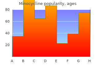 buy minocycline 50mg without a prescription