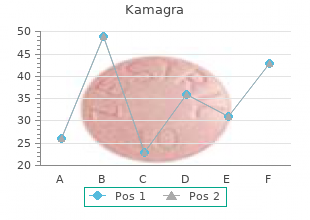 discount 50mg kamagra otc