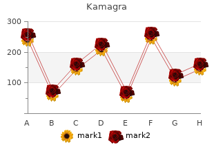 cheap kamagra 50mg with mastercard