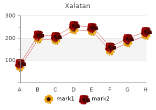 buy discount xalatan 2.5 ml online