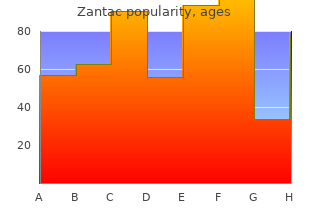 generic 150mg zantac