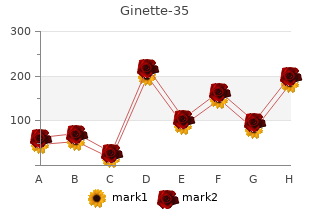 order ginette-35 2mg overnight delivery